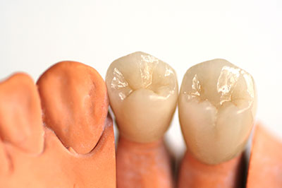 Gaithersburg Complete Dental Care, LLC | Full Mouth Reconstruction, Veneers and Botox reg 