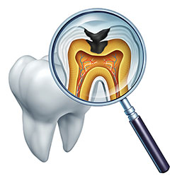 Gaithersburg Complete Dental Care, LLC | Inlays  amp  Onlays, Implant Dentistry and Preventative Program