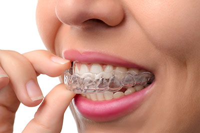 Gaithersburg Complete Dental Care, LLC | All-on-6 reg , Implant Dentistry and TMJ Disorders