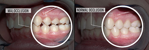 Gaithersburg Complete Dental Care, LLC | Implant Dentistry, Veneers and Botox reg 