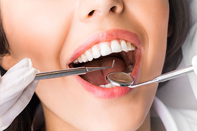 Gaithersburg Complete Dental Care, LLC | Veneers, Preventative Program and Ceramic Crowns