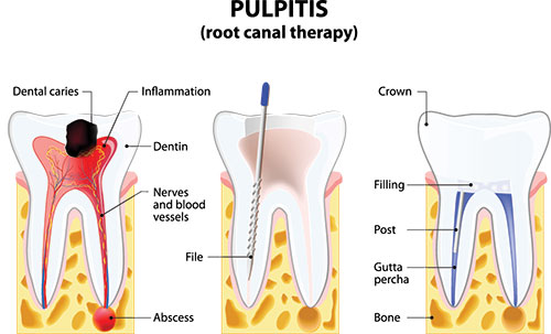 Gaithersburg Complete Dental Care, LLC | Implant Restorations, Emergency Treatment and Pediatric Dentistry