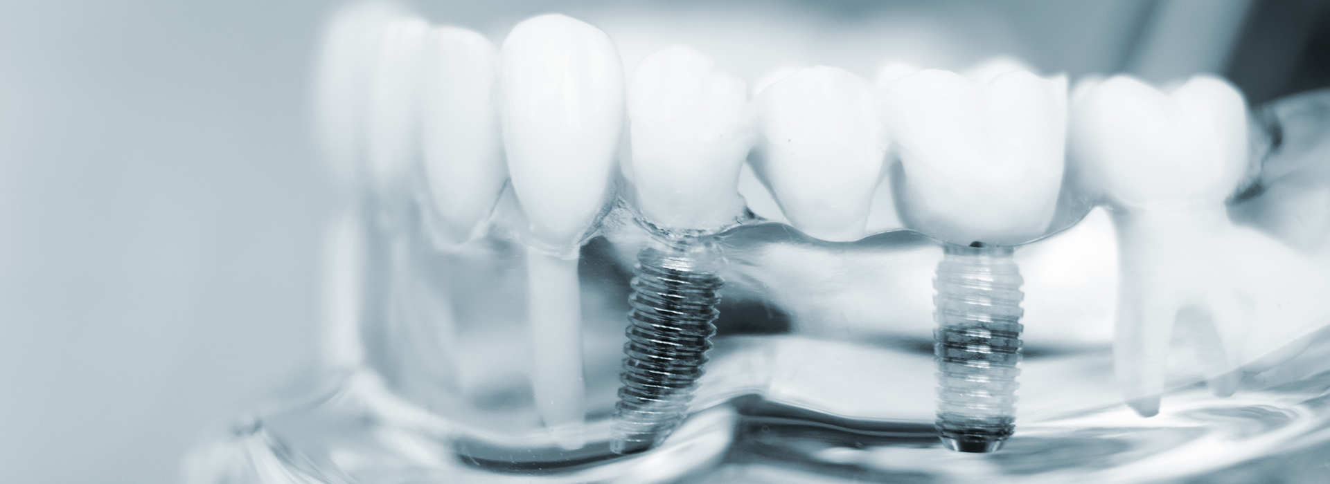 Gaithersburg Complete Dental Care, LLC | Pediatric Dentistry, Dermal Fillers and Dental Sealants