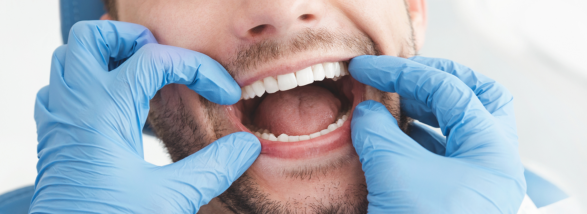 Gaithersburg Complete Dental Care, LLC | Sports Mouthguards, Juvederm reg  and Full Mouth Reconstruction