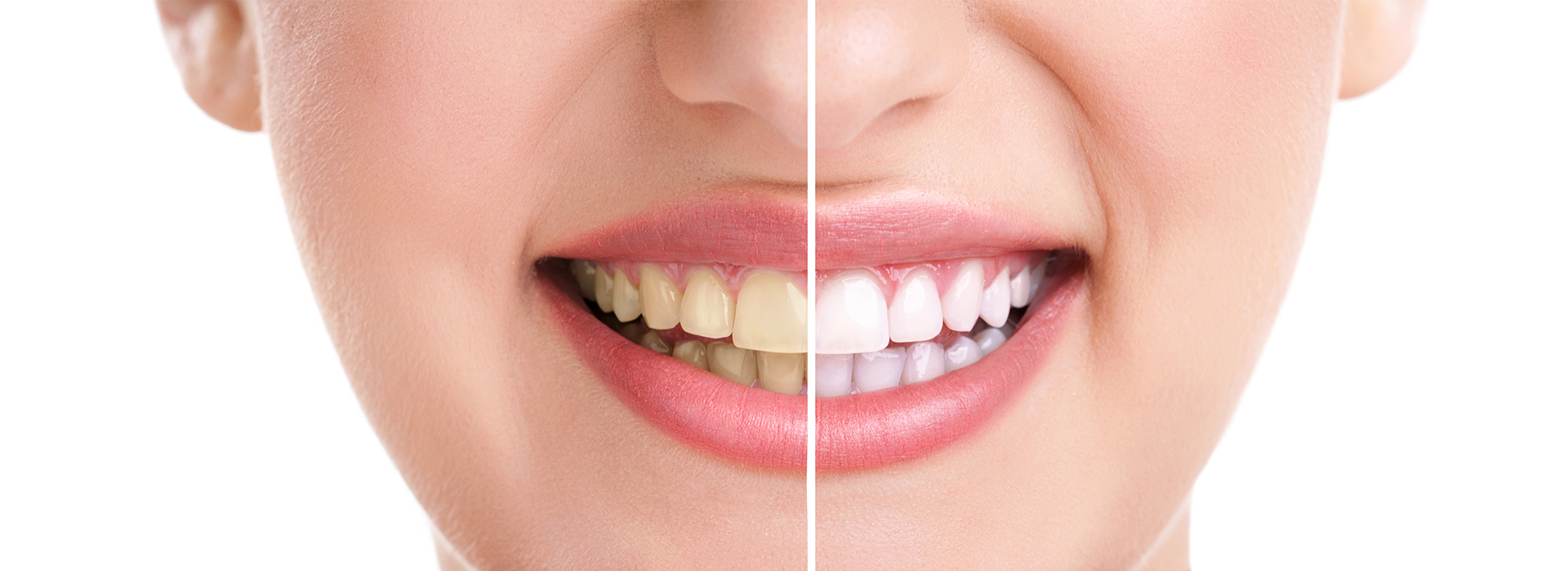 Gaithersburg Complete Dental Care, LLC | Dentures, Root Canals and Invisalign reg 