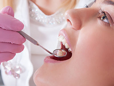 Gaithersburg Complete Dental Care, LLC | Preventative Program, Dental Fillings and Invisalign reg 